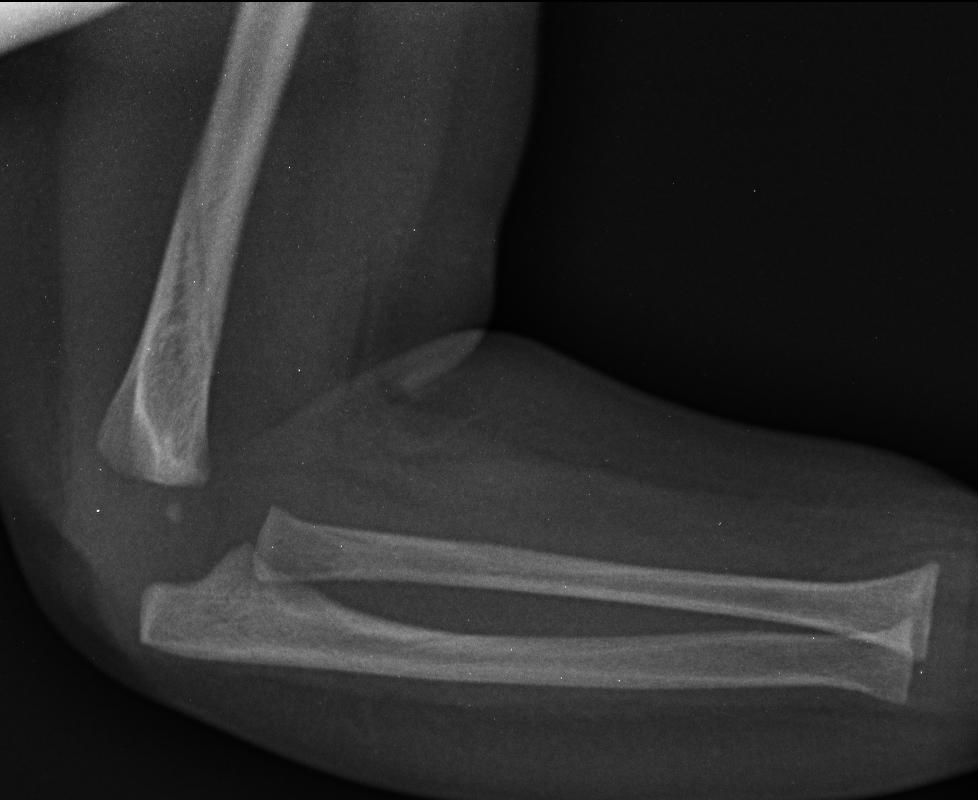 Child-presenting with-fall-scenario.jpg