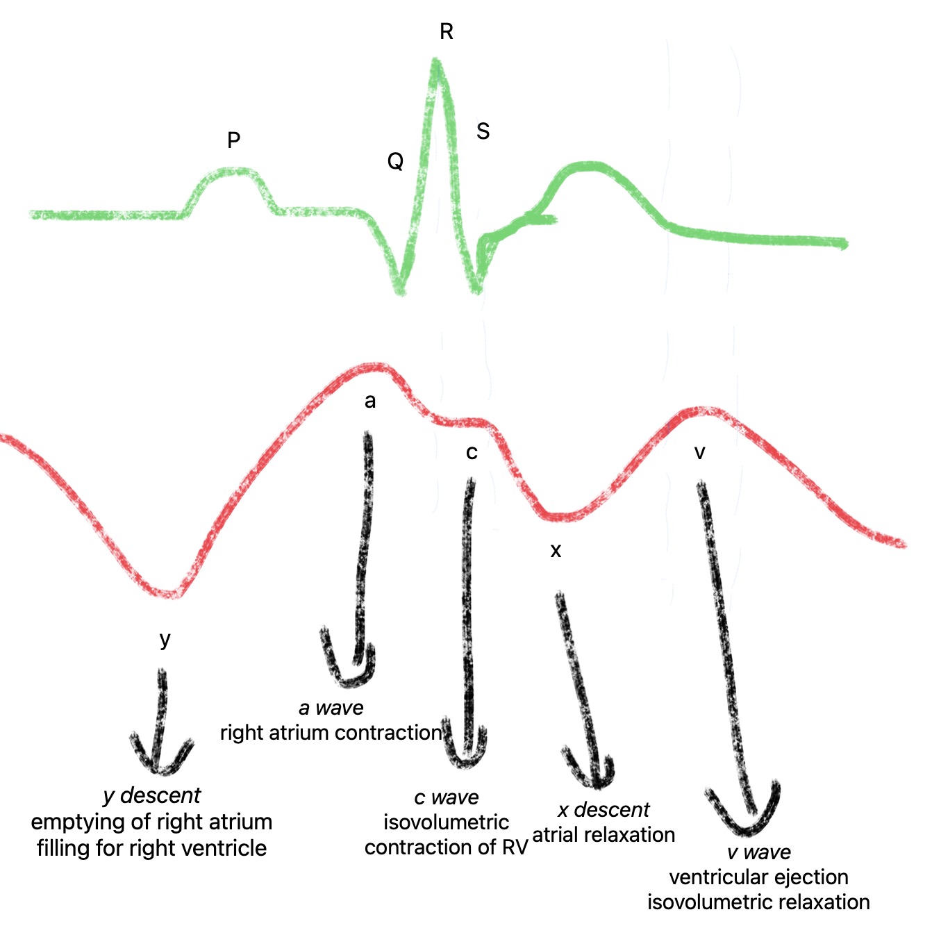 cvp waveform diagram.jpg