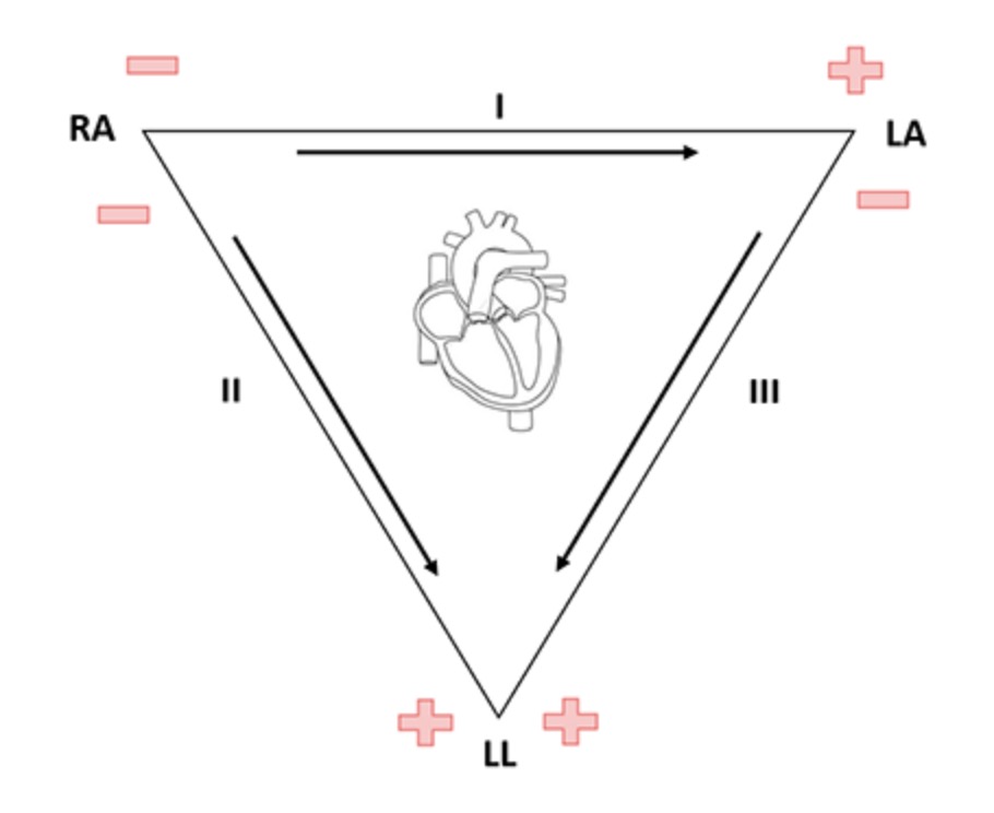 einthoven diagram.jpg