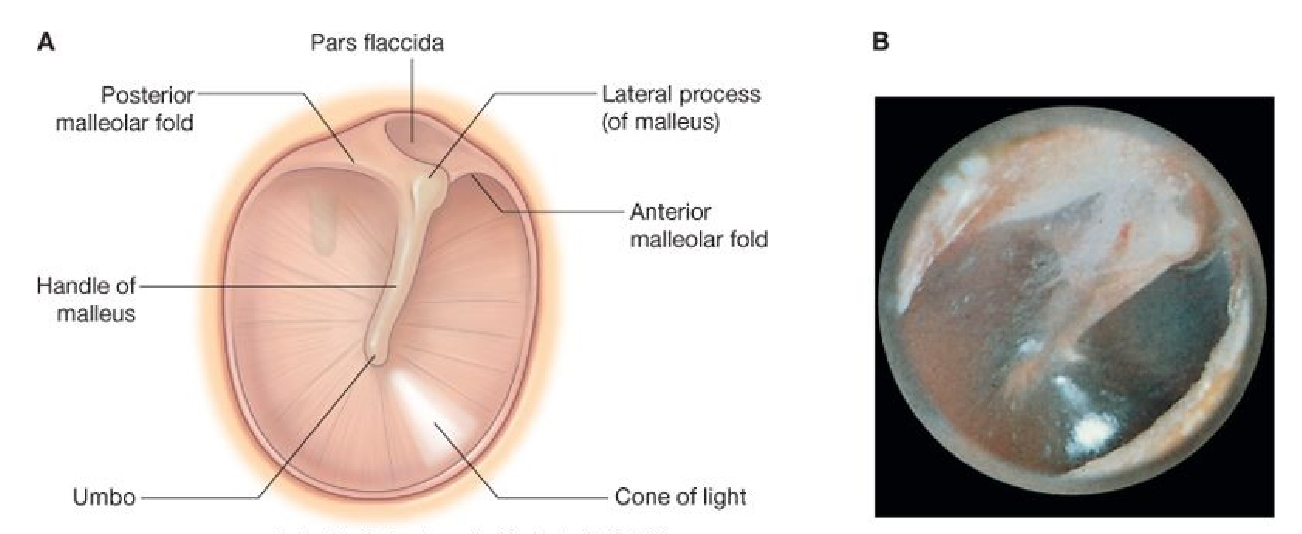 grays-tympanic-membrane-parts.jpg