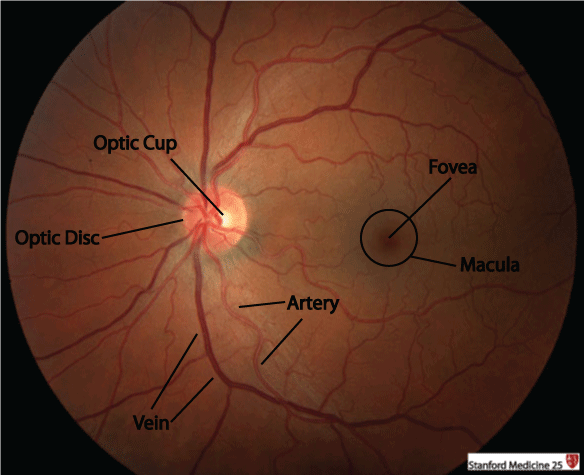 normal retina fundoscopy stanford.png