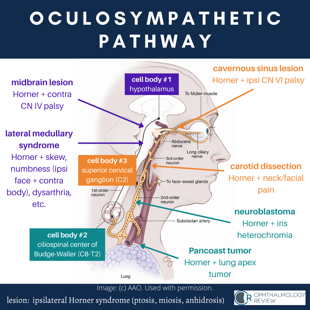Oculosympathetic+Pathway.png