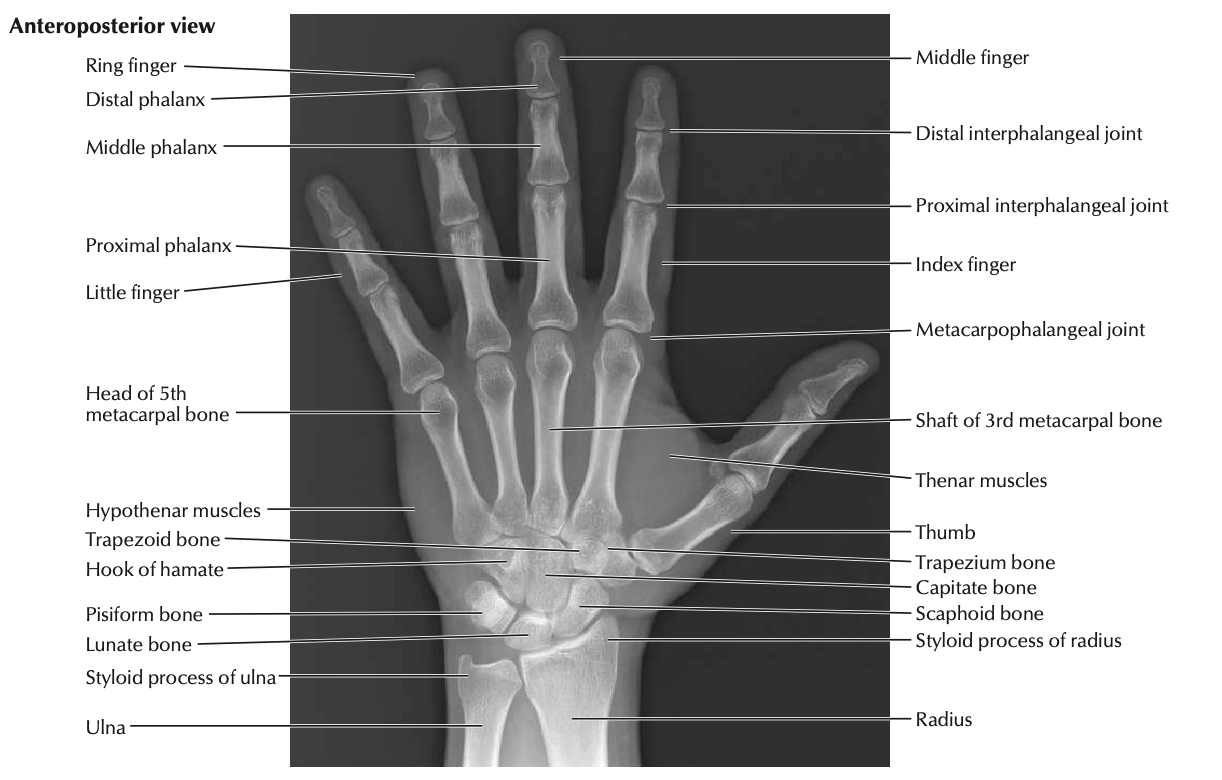 wrist radiograph netter AP.jpg