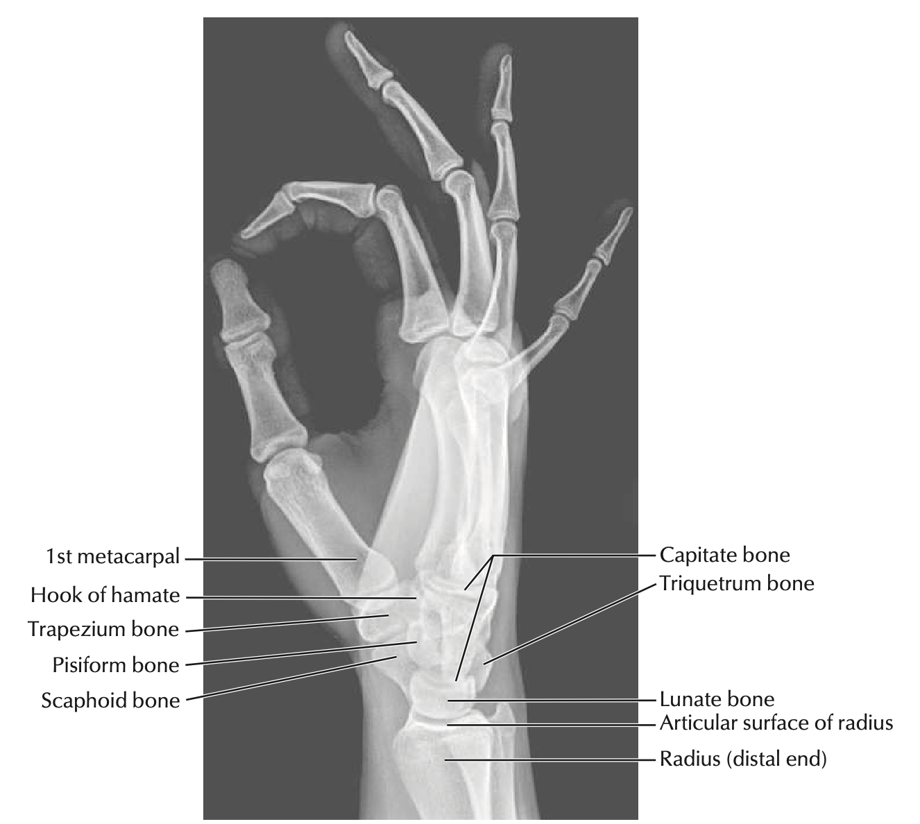 wrist radiograph netter lat.jpg